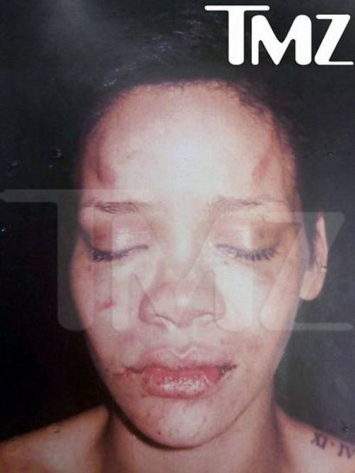 Pics of Rihanna Beat Up